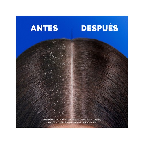 H&S Menthol fresh Champú anticaspa de uso diario, para todo tipo de cabello 625 ml.
