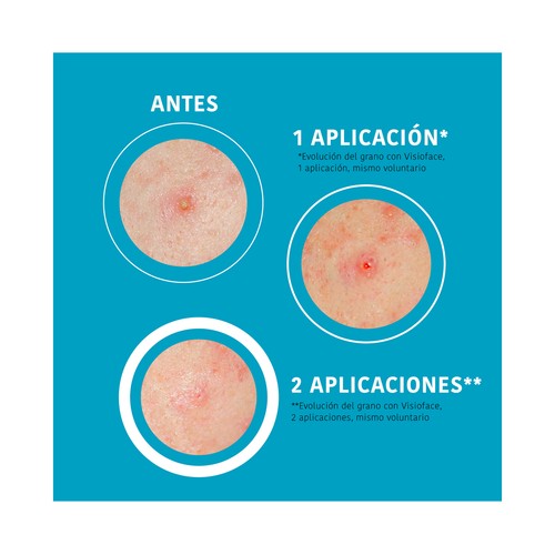 IROHA NATURE Parches hidrocoloides para tratar los granos, pieles normales, mixtas o grasas 18 uds.