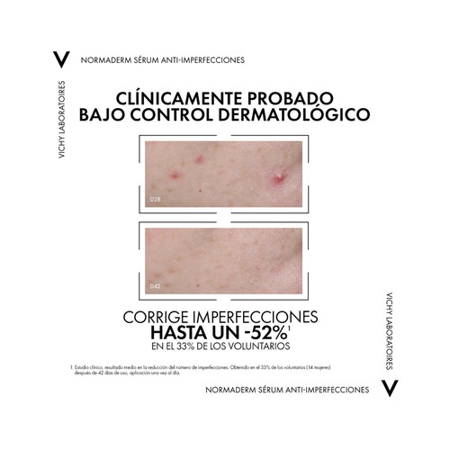 VICHY Sérum anti imperfecciones para pieles propensas al acné VICHY Normaderm probio-bha 30 ml.
