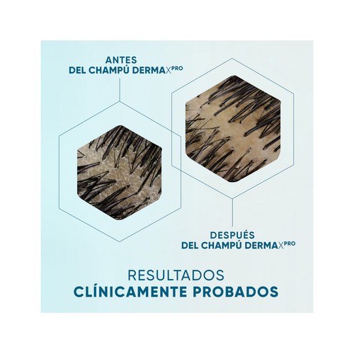 H&S Derma xpro Champú anticaspa calmante para cuero cabelludo seco y/o con picor 300 ml.