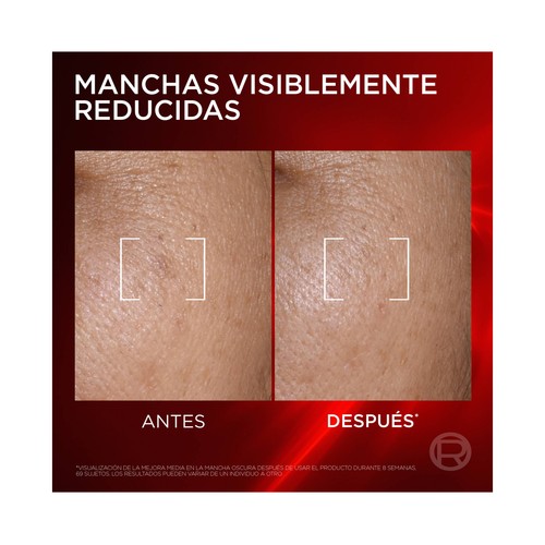 L´ORÉAL PARIS Revitalift laser Sérum facial anti-edad y anti-manchas 50 ml.