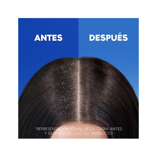 H&S Classic Champú anticaspa de uso diairo 90 ml.