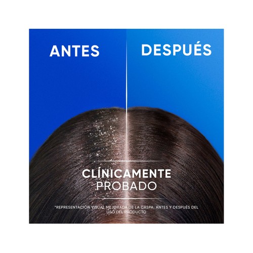 H&S Citrus fresh Champú y acondicionador anticaspa, para cabellos grasos 300 ml.