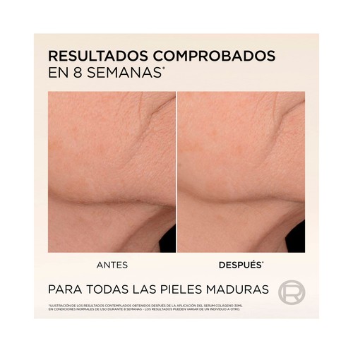 L´ORÉAL PARIS Age perfect Sérum facial anti-flacidez con micro-colágeno 30 ml.