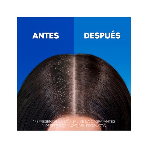 H&S Champú anticaspa y anticaída, con cafeína H&S 1 l.