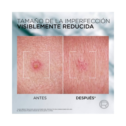 L´ORÉAL PARIS Men expert derma control Pasta anti-imperfecciones y anti granos (S.O.S pimple paste) 45 ml.