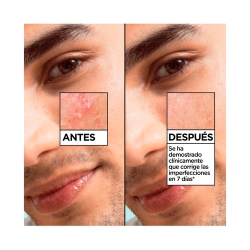 GARNIER Pure active salicylic Sérum facial anti-imperfecciones, fórmula ligera y de rápida absorción 30 ml. 
