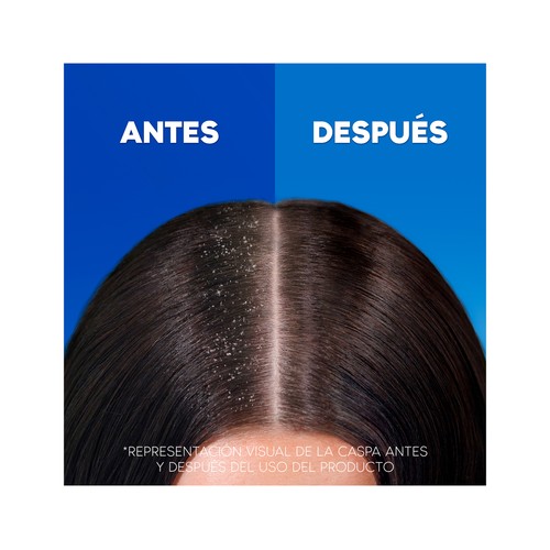 H&S Champú anticaspa de uso diario H&S Nutre & cuida 400 ml.